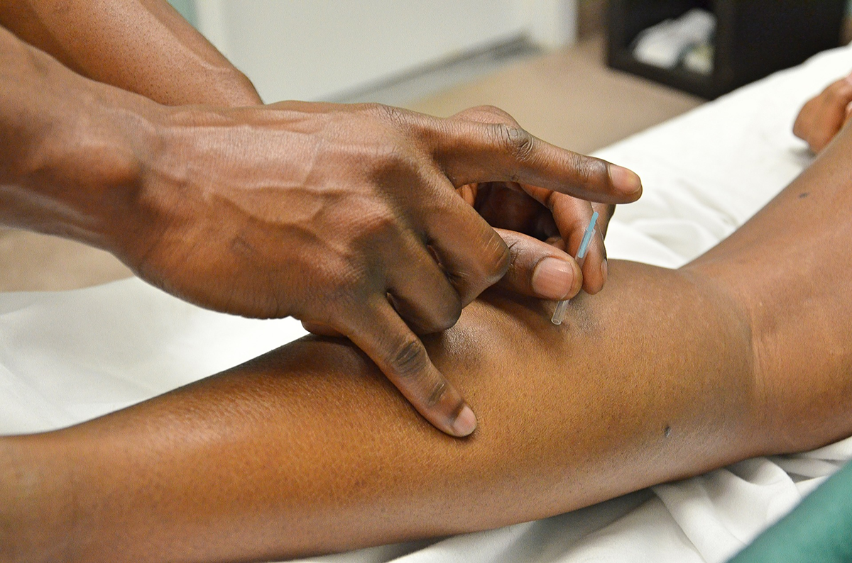 Image: Best Acupuncturist