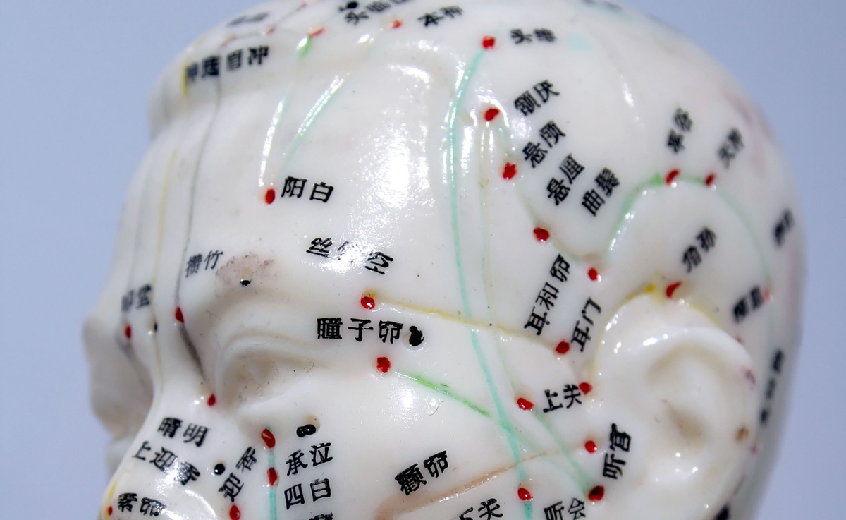 Image: BEST ACUPUNCTURIST