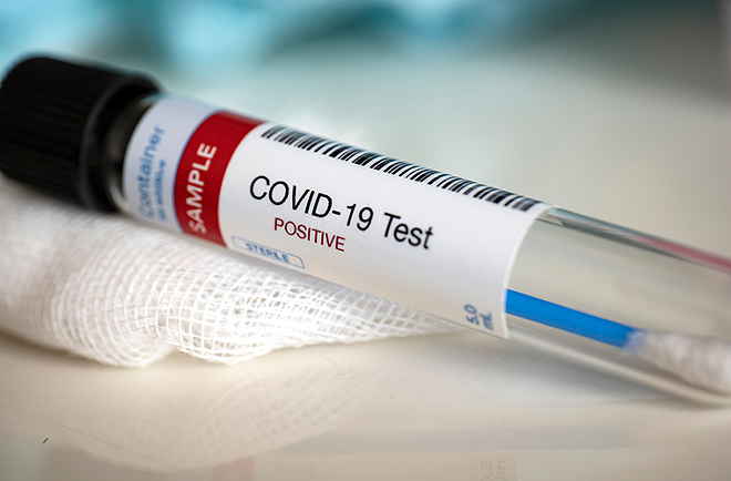 BayCare is offering Tampa Bay residents drive-through coronavirus testing