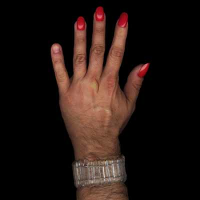 THAT HAND! Images from Santiago Echeverry's "Heal Series" document his attempts to revive the drag persona Patty E. Patetik, whose signs of age are now harder to conceal. - Courtesy Of The Artist